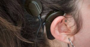implante-coclear-audifono.jpg